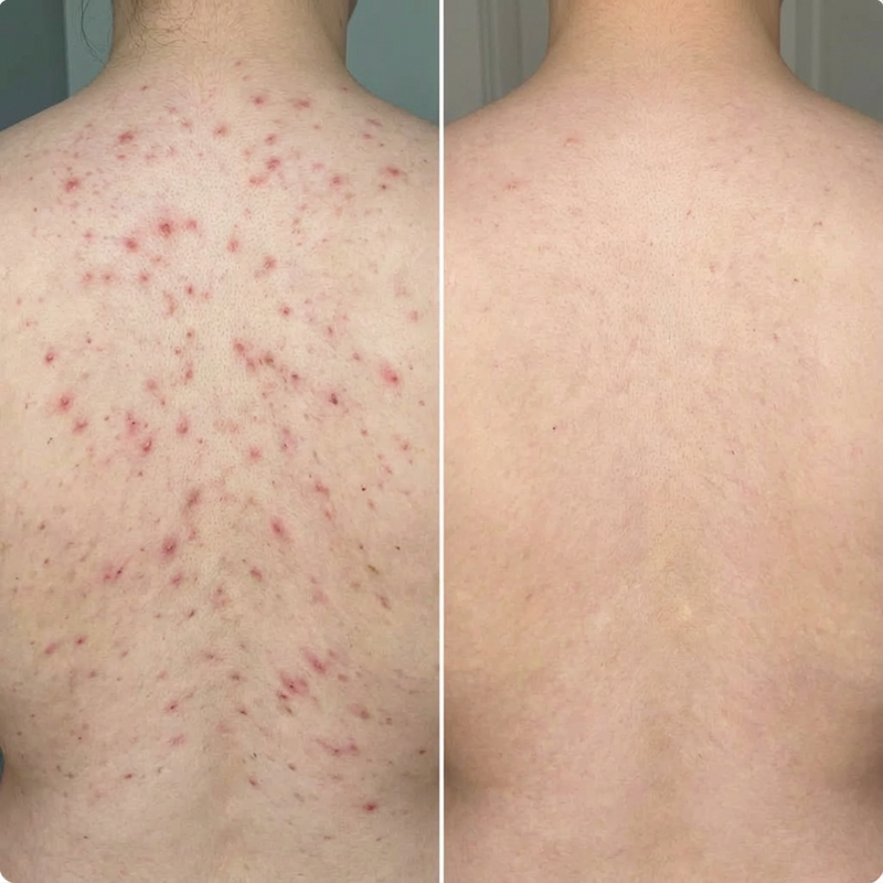 Before and after - James R.