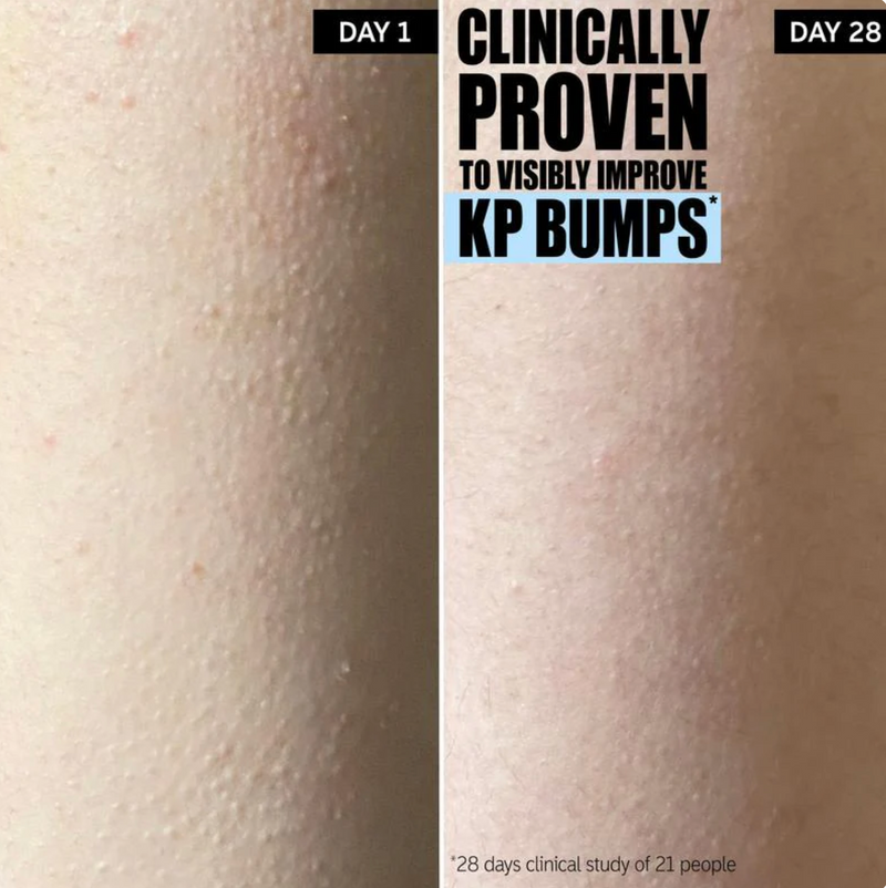 Before and after - Jessica L.