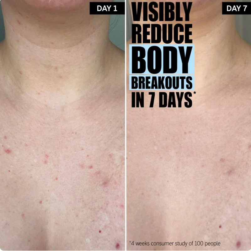 Before and after - Sarah M.
