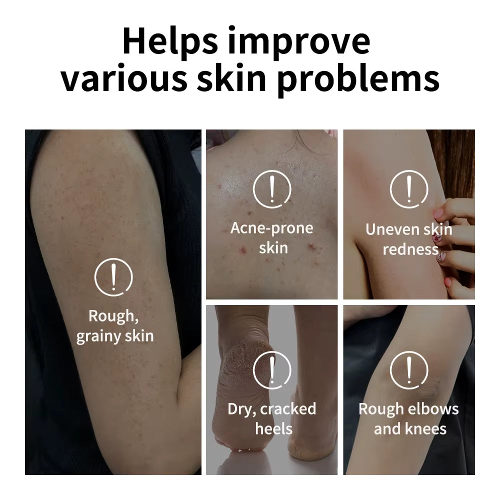 Body Effective Exfoliation Stick Glycolic Acid Exfoliating Deep Exfoliation Nourishing Moisture Deep Hydration Skincare
